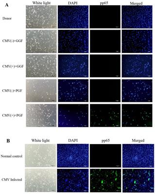 Cytomegalovirus results in poor graft function via bone marrow-derived endothelial progenitor cells